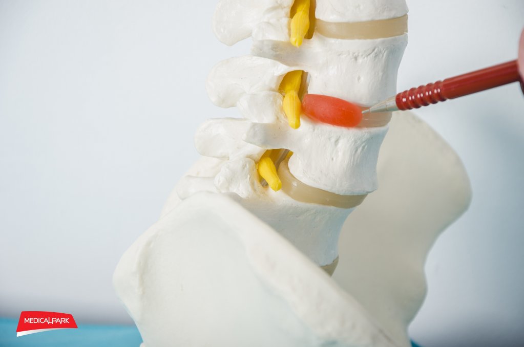 Munca la calculator şi hernia de disc cervical