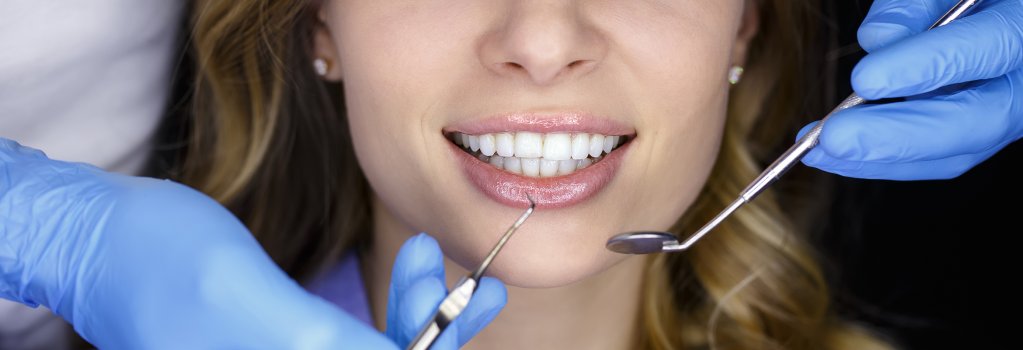 Ce este estetica dentara si de ce este atat de importanta pentru fiecare dintre noi?