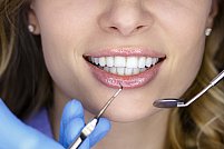 Ce este estetica dentara si de ce este atat de importanta pentru fiecare dintre noi?