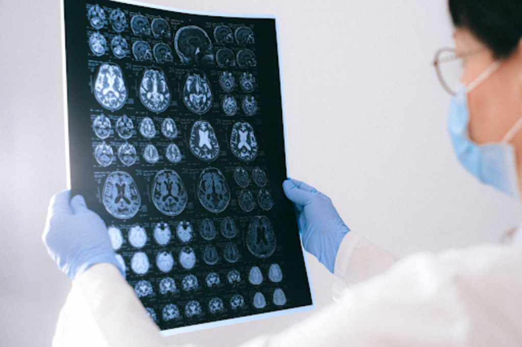 Cauze si tratament contra epilepsiei
