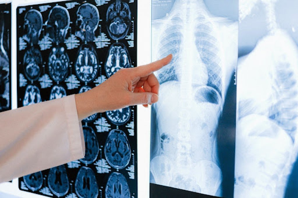 Ce boli poate depista un examen radiologic?