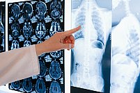 Ce boli poate depista un examen radiologic?