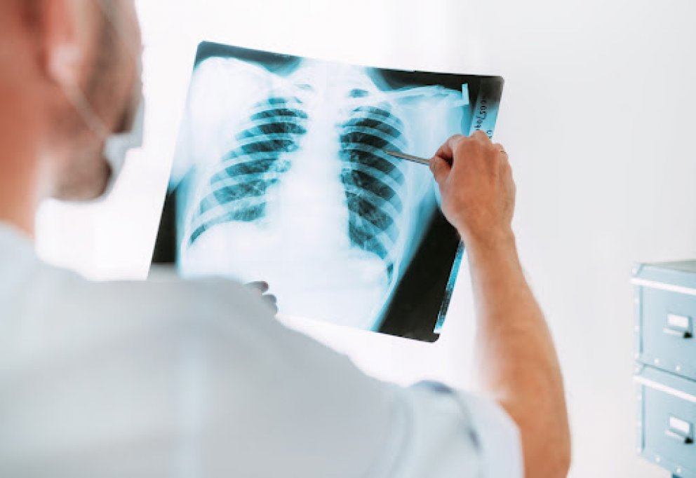 Ce este tuberculoza si cum se manifesta