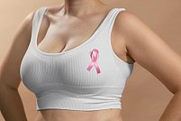 Implanturile mamare și screeningul pentru cancer la sân