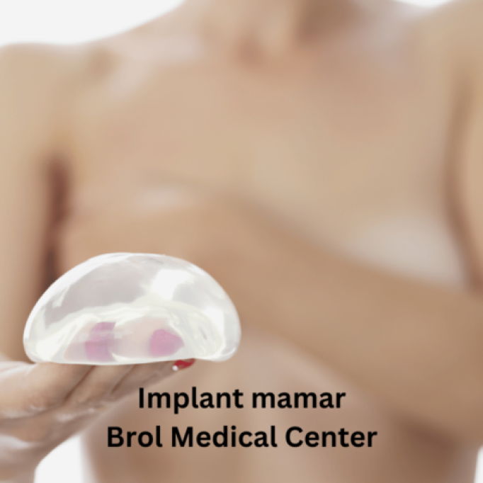 Tipuri de implant mamar si care este cel mai potrivit pentru dumneavoastra?