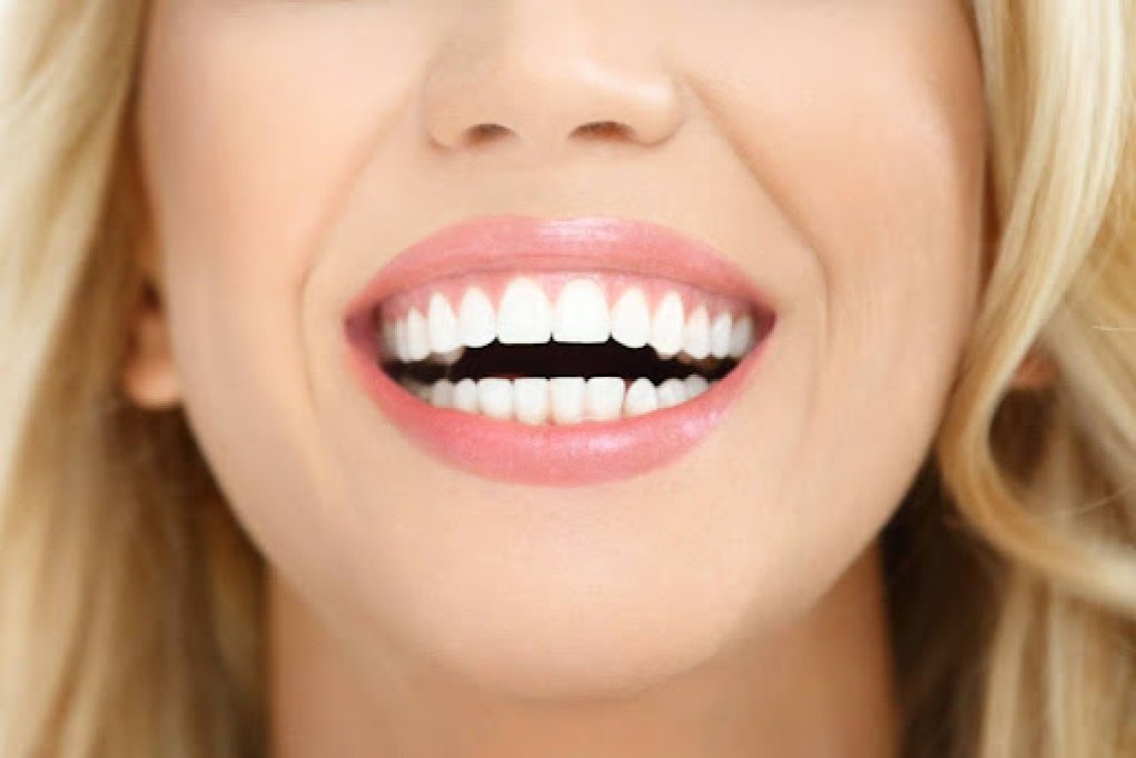 Transformarea zâmbetului: o analiză a esteticii dentare și a soluțiilor accesibile