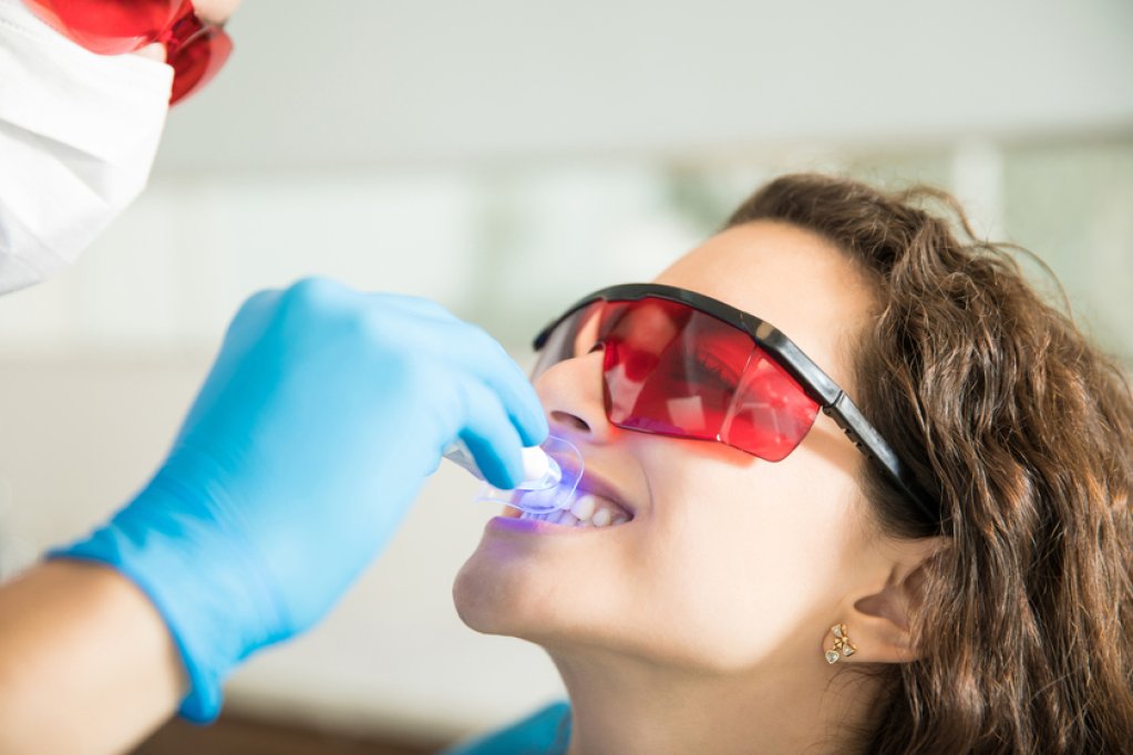 5 motive să alegi un tratament dentar cu laser: principalele beneficii