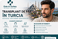 Transplantul de păr în Turcia: ce merită verificat înainte să alegi o clinică
