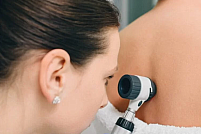 Semnalele pe care pielea le transmite după vară: când este necesar un consult dermatologic